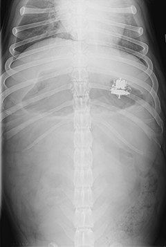 Figure 3. Example of a radiograph (X-Ray) with gastrointestinal foreign bodies present.