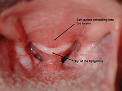 Soft Palate Disorders in Dogs - Symptoms, Causes, Diagnosis