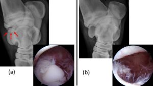 Figure 2: Hock OCD before (a) and after (b) fragment removal via arthroscopy. The OCD fragment is highlighted with red arrows.