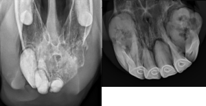 Figure 1. Radiographs (x-rays) from two different horses with significant EOTRH. Tooth roots are enlarged and rounded, with bone loss/resorption of the most severely affected teeth.
