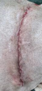 Figure 1. Picture of normal incision with intradermal sutures.
