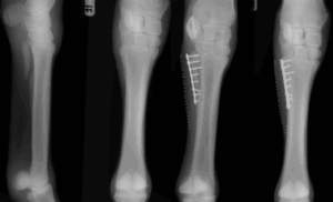 Figure 5. Pre-operative and post-operative radiographs of a splint bone fracture involving the upper (proximal) one third of the bone.